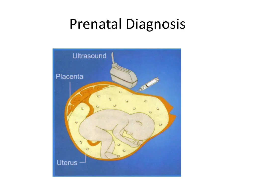 prenatal diagnosis