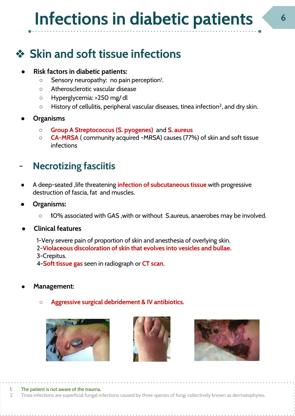 infections in diabetic patients 3