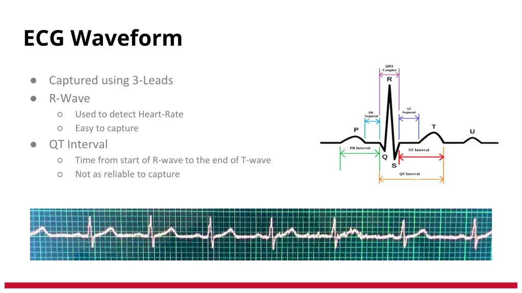 ecg waveform