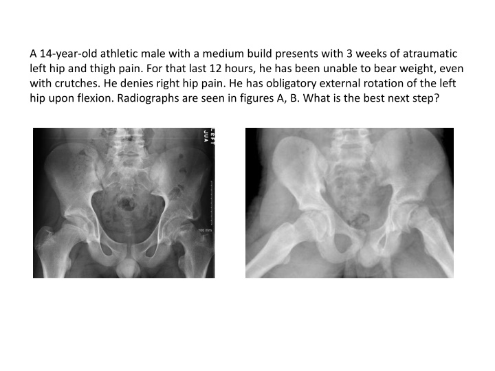 a 14 year old athletic male with a medium build