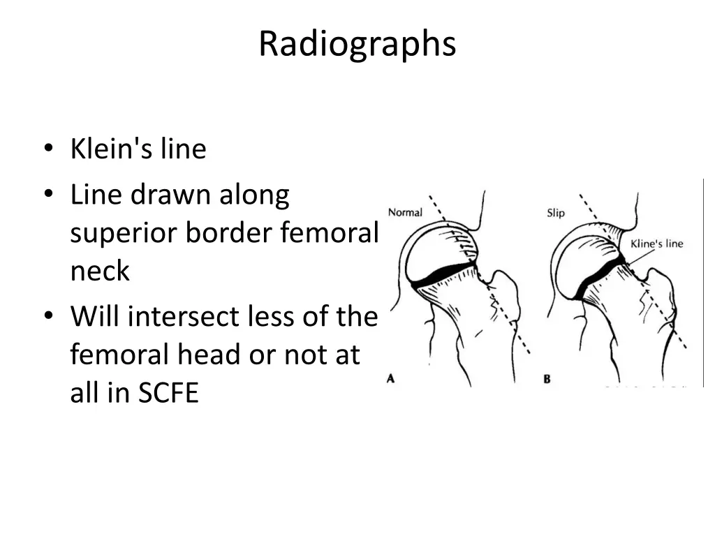 radiographs 1