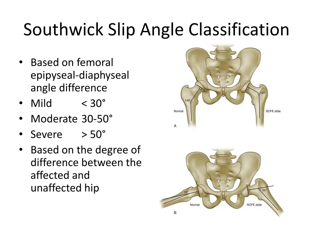 southwick slip angle classification