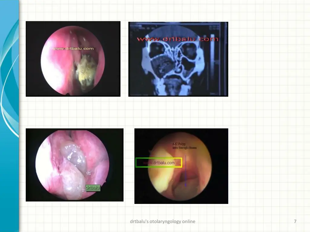 drtbalu s otolaryngology online