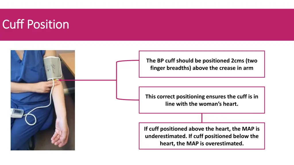 cuff position cuff position