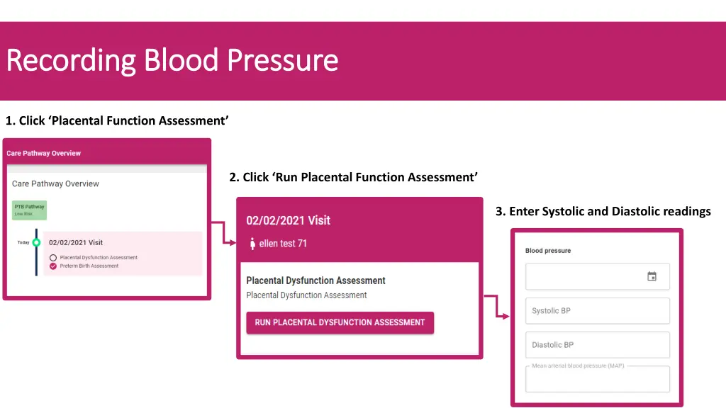 recording blood pressure recording blood pressure