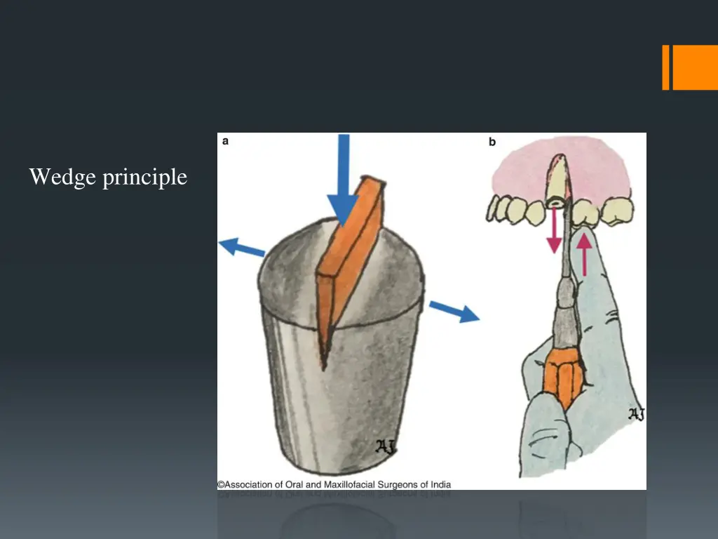 wedge principle 1