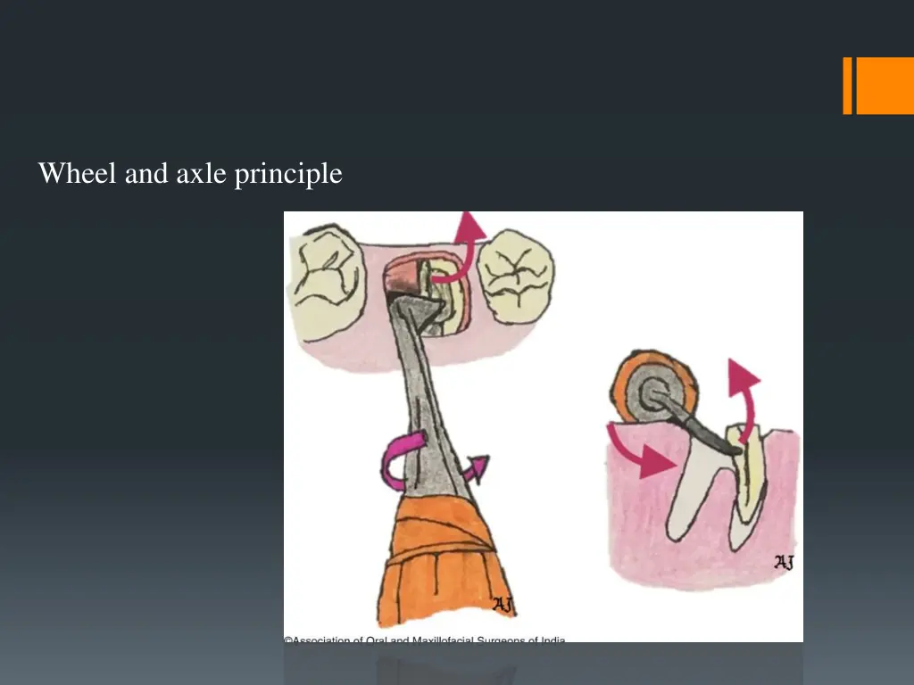 wheel and axle principle 1