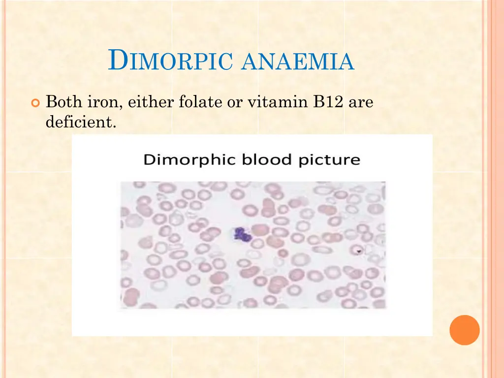 d imorpic anaemia