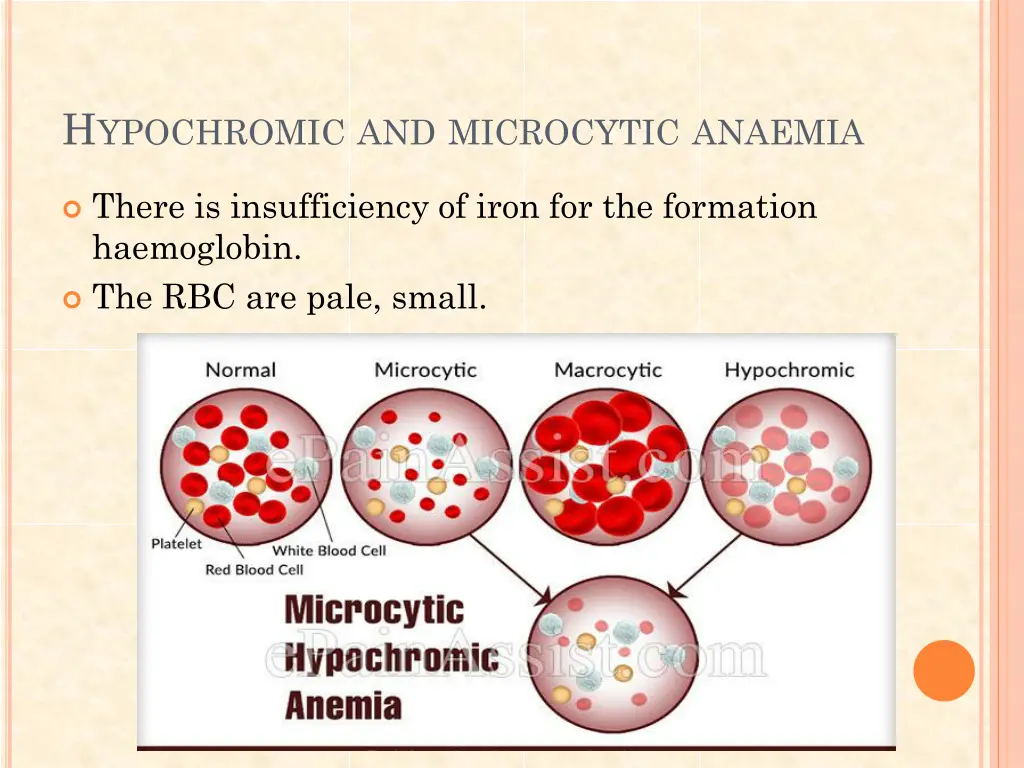 h ypochromic and microcytic anaemia