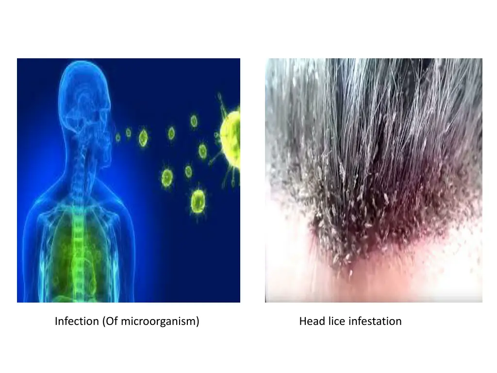 infection of microorganism