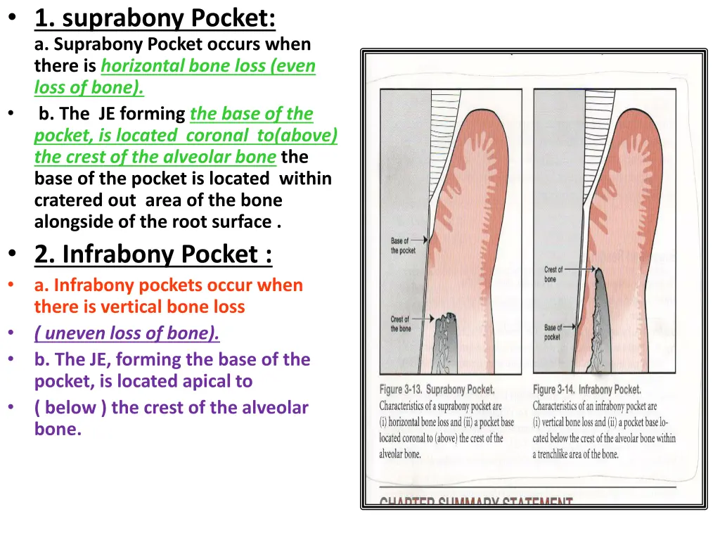 1 suprabony pocket a suprabony pocket occurs when