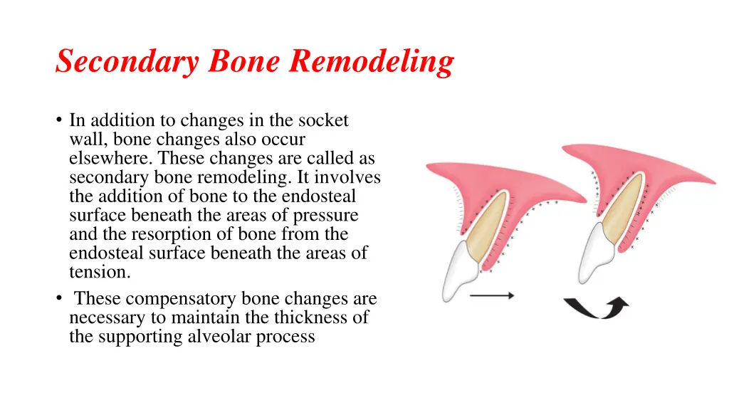 secondary bone remodeling