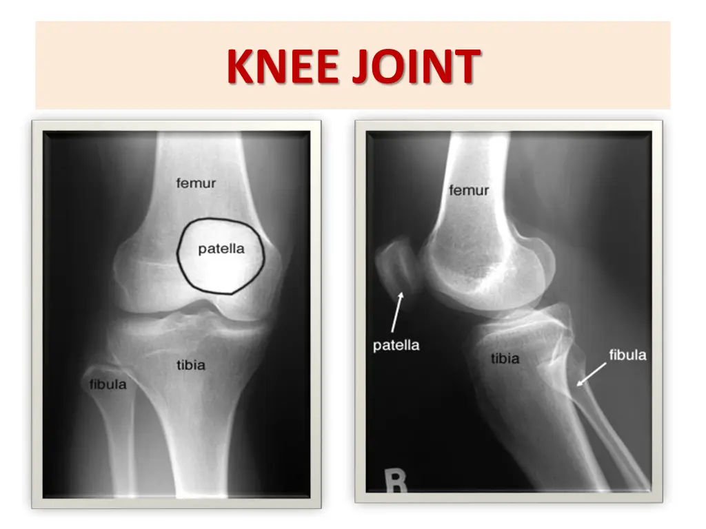 knee joint 1