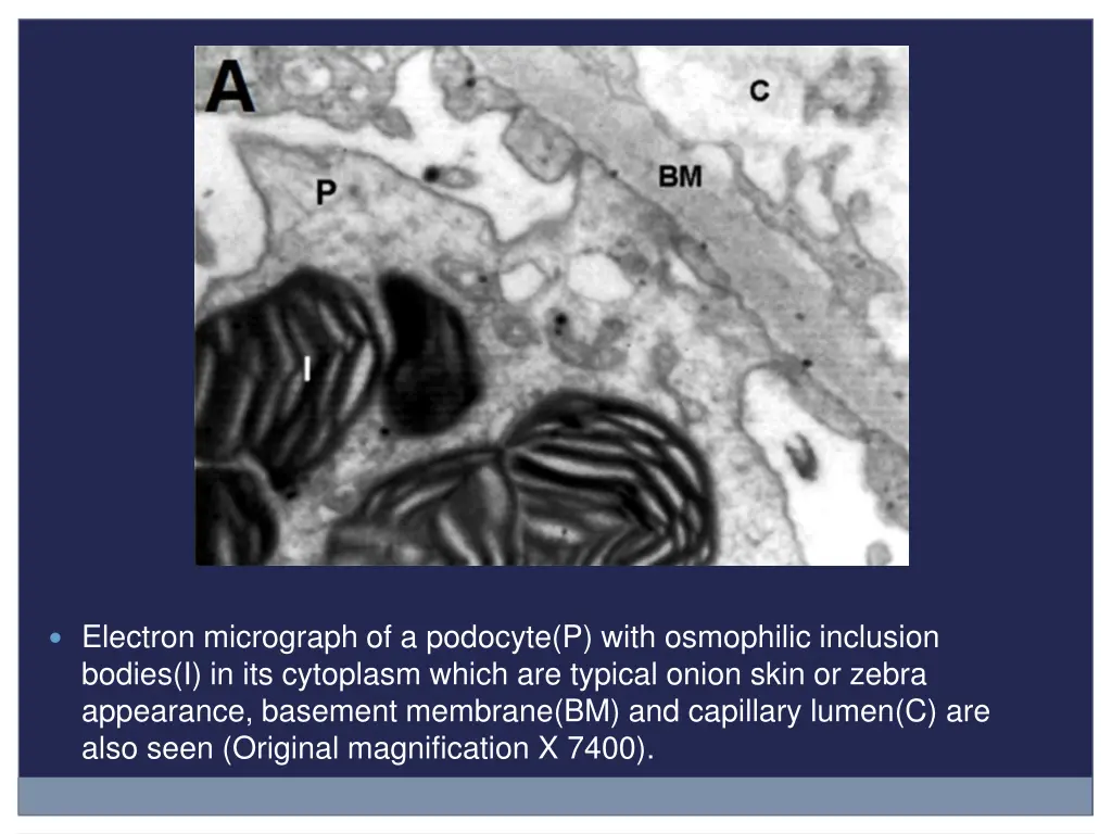 electron micrograph of a podocyte p with