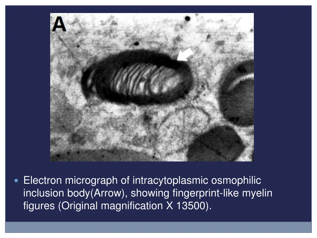 electron micrograph of intracytoplasmic