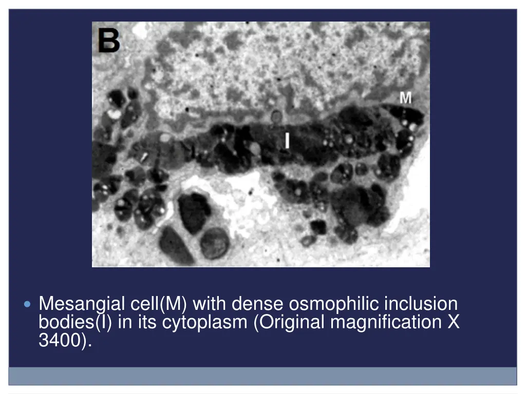 mesangial cell m with dense osmophilic inclusion