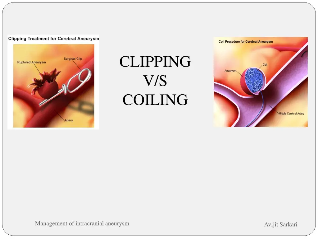 clipping v s coiling