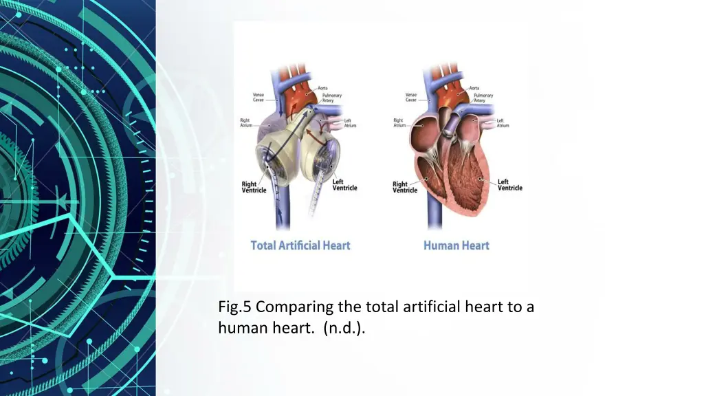 fig 5 comparing the total artificial heart