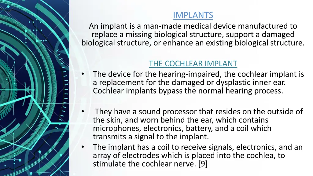 implants