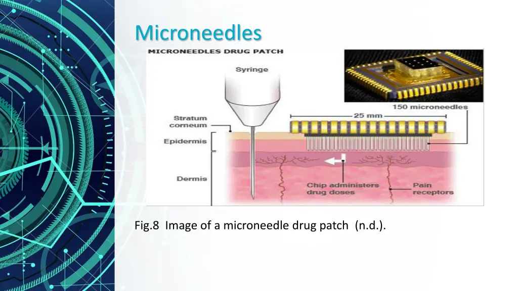 microneedles