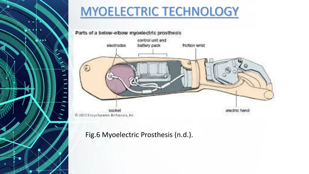 myoelectric technology 1