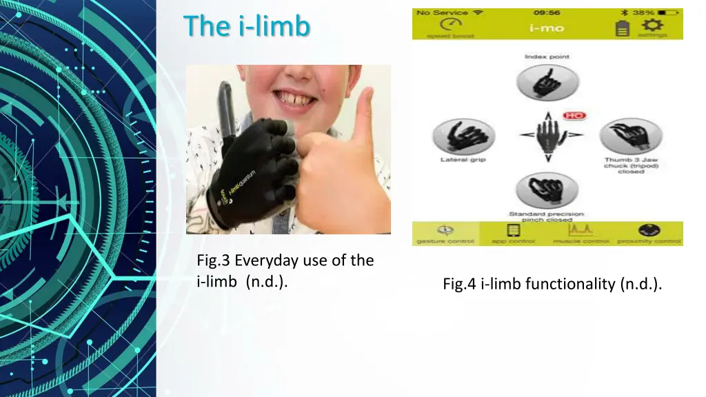 the i limb 1