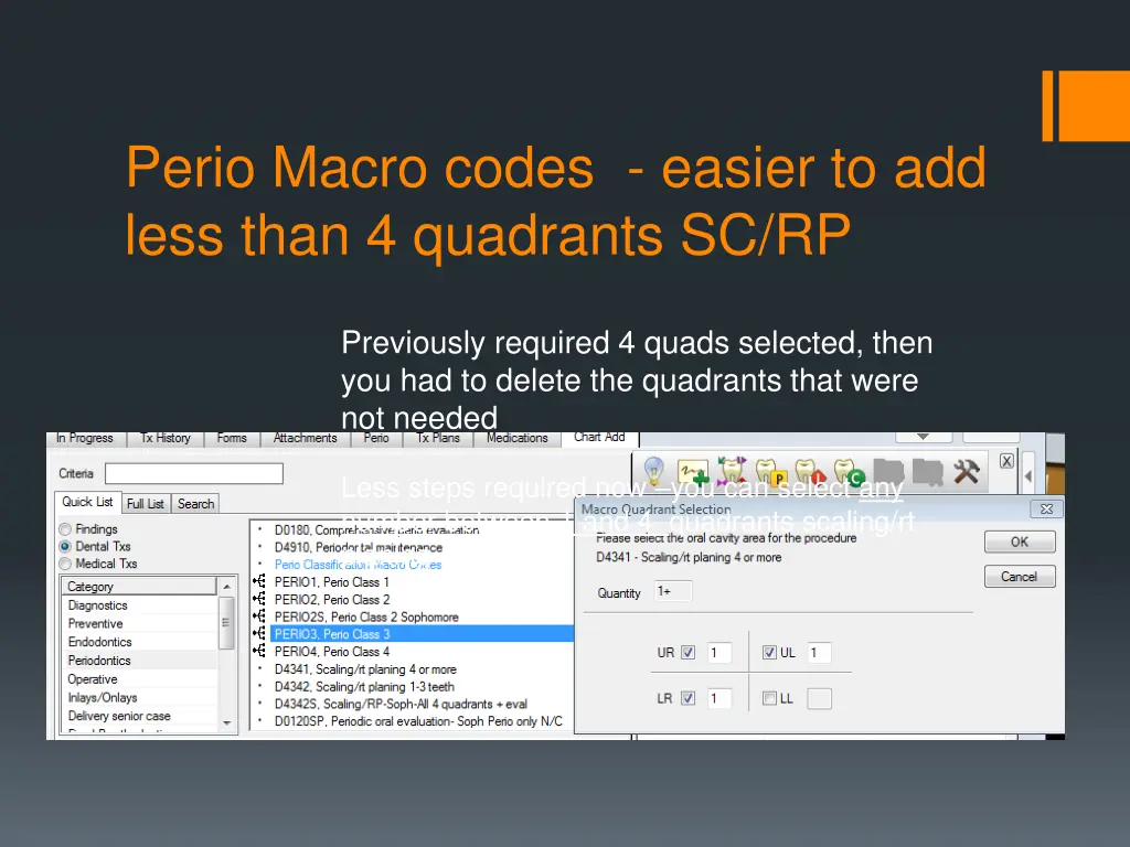 perio macro codes easier to add less than