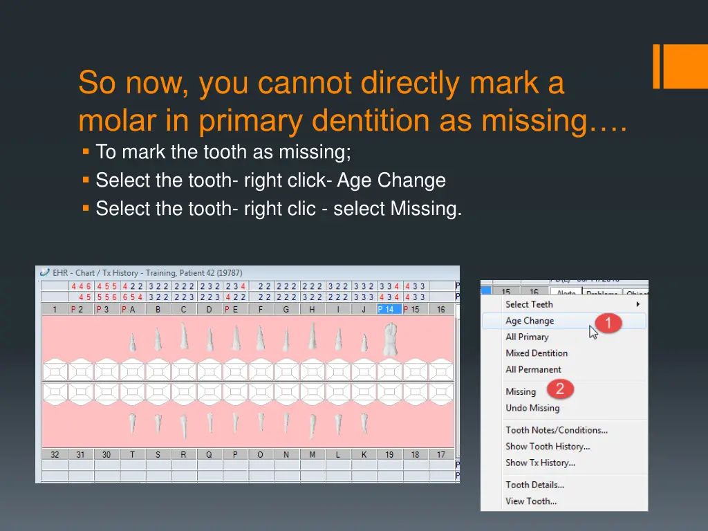 so now you cannot directly mark a molar