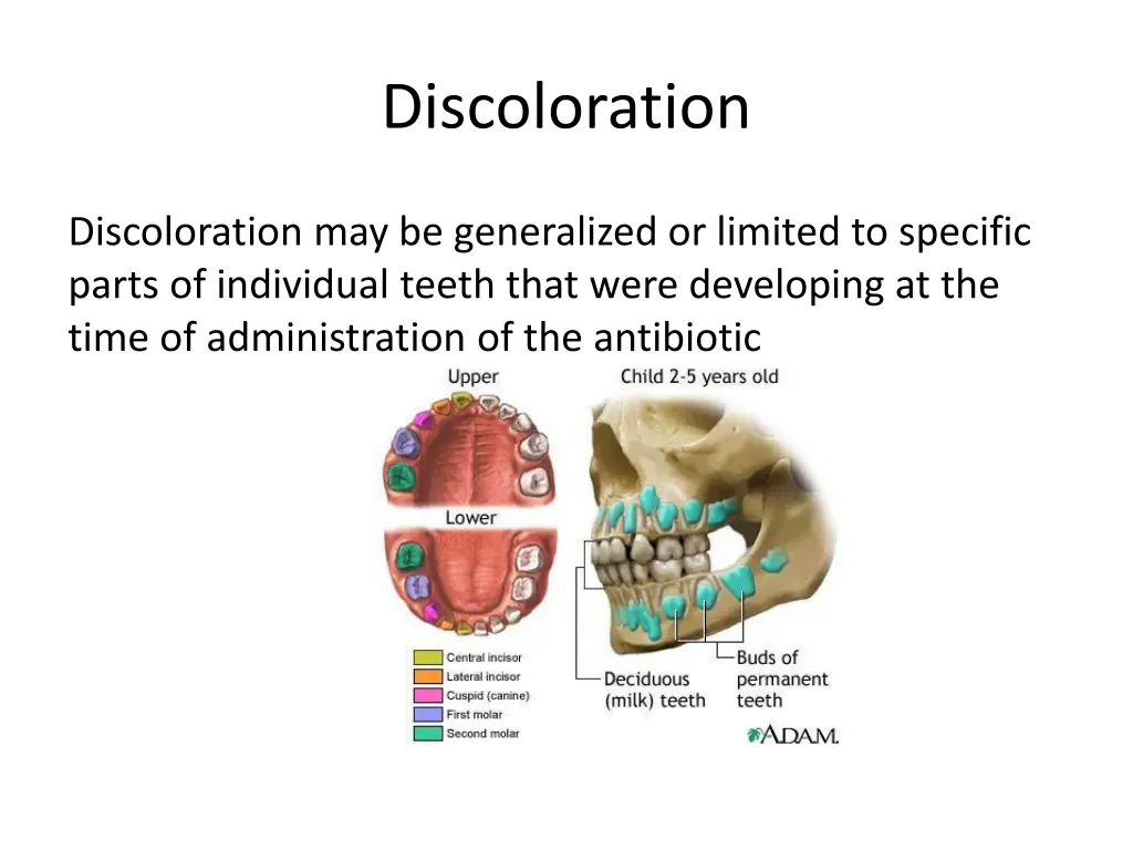 discoloration