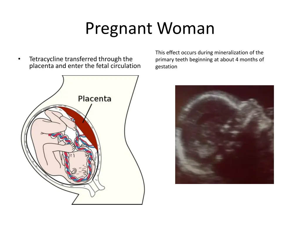 pregnant woman