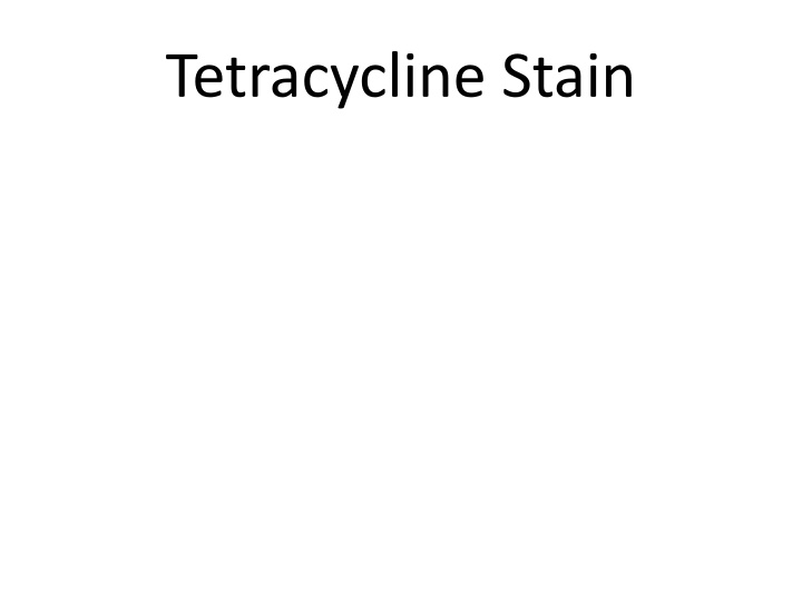 tetracycline stain