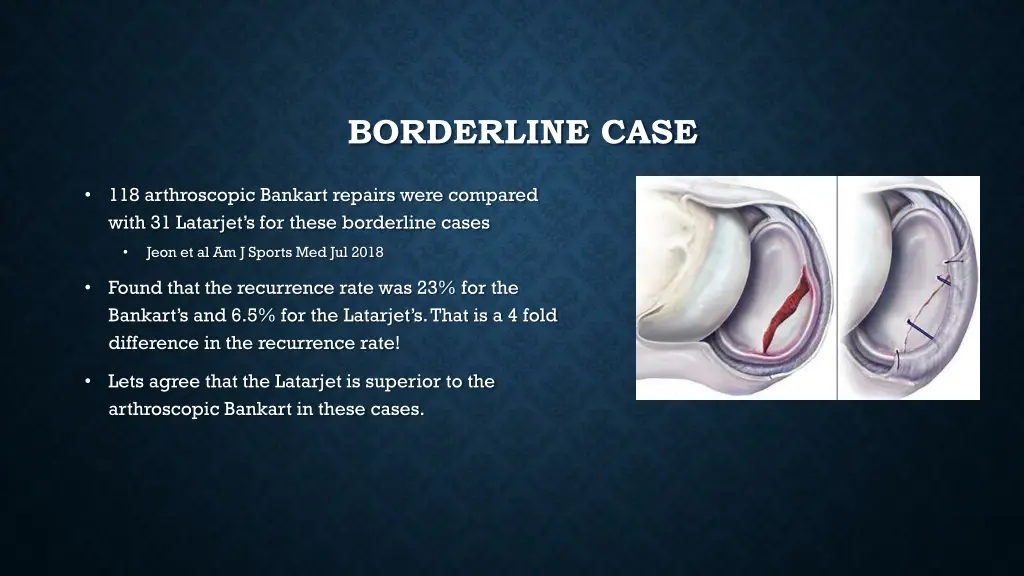 borderline case