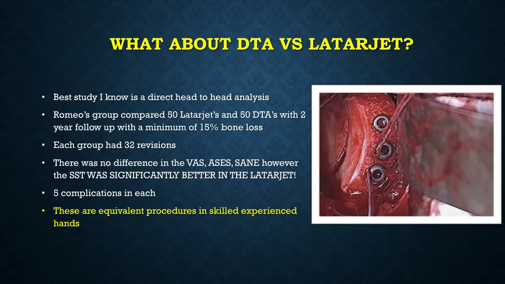 what about dta vs latarjet