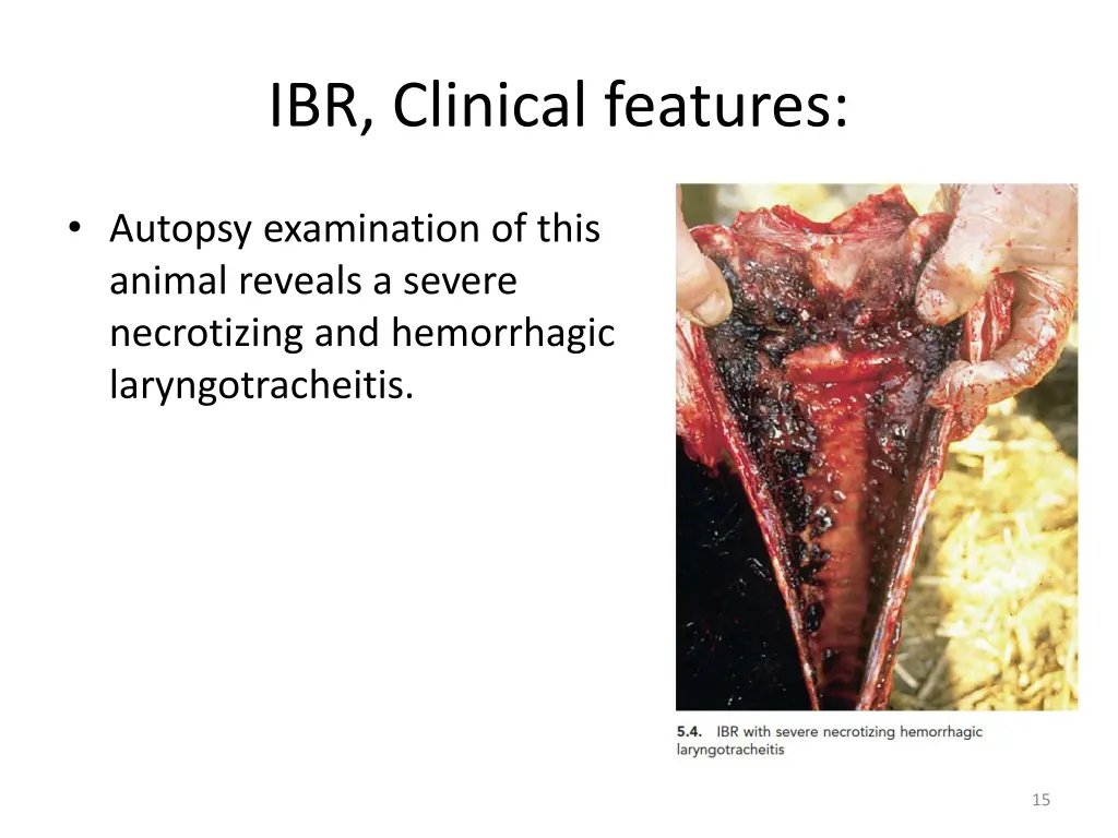 ibr clinical features 4