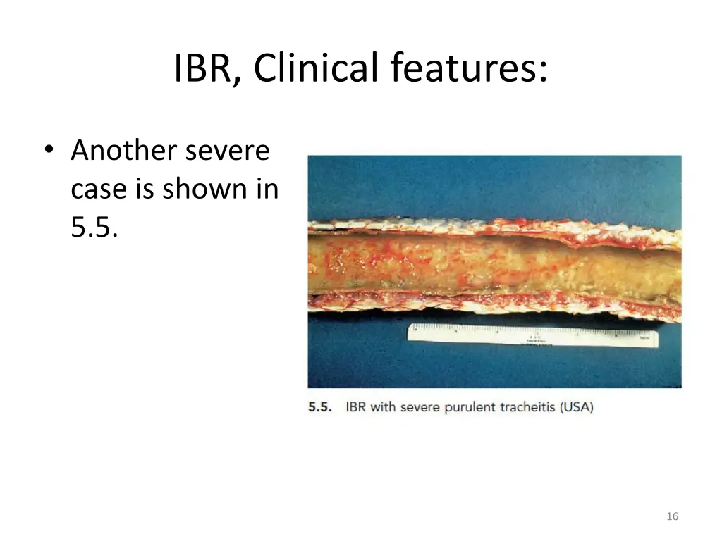 ibr clinical features 5