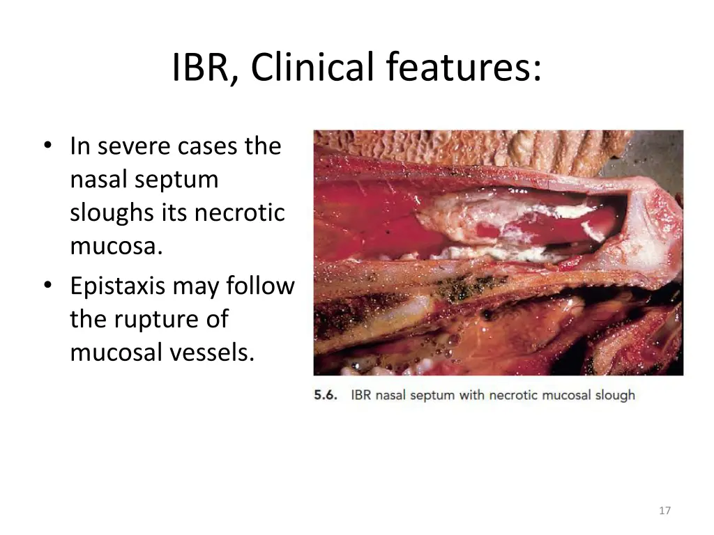 ibr clinical features 6