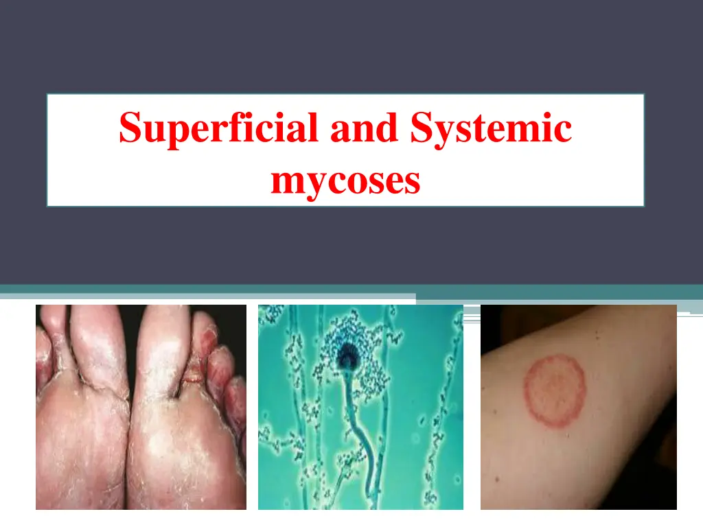 superficial and systemic mycoses