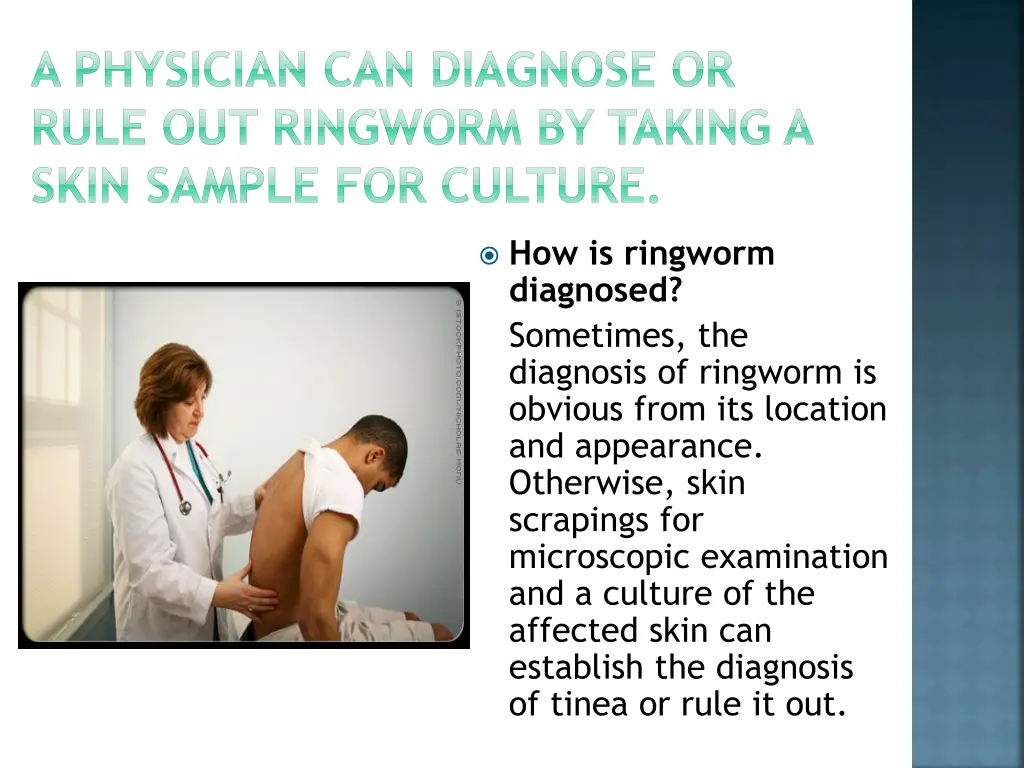 a physician can diagnose or rule out ringworm