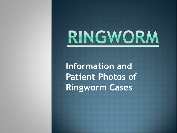 ringworm