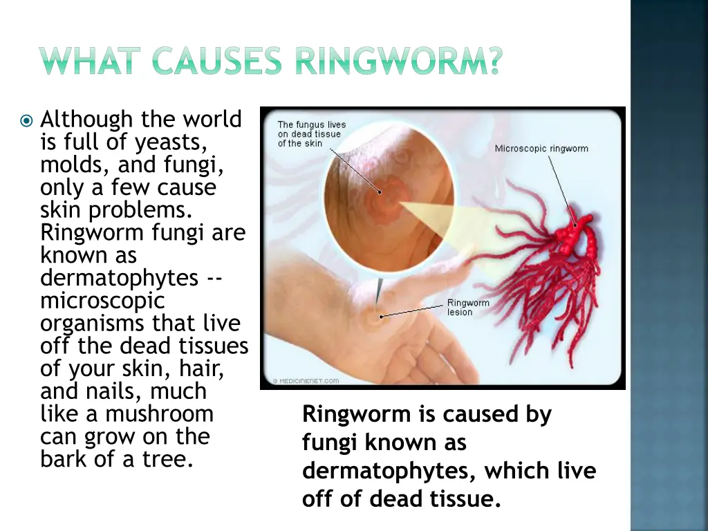 what causes ringworm