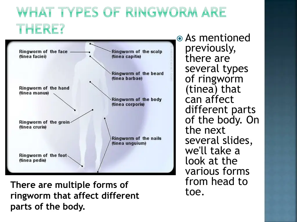 what types of ringworm are there