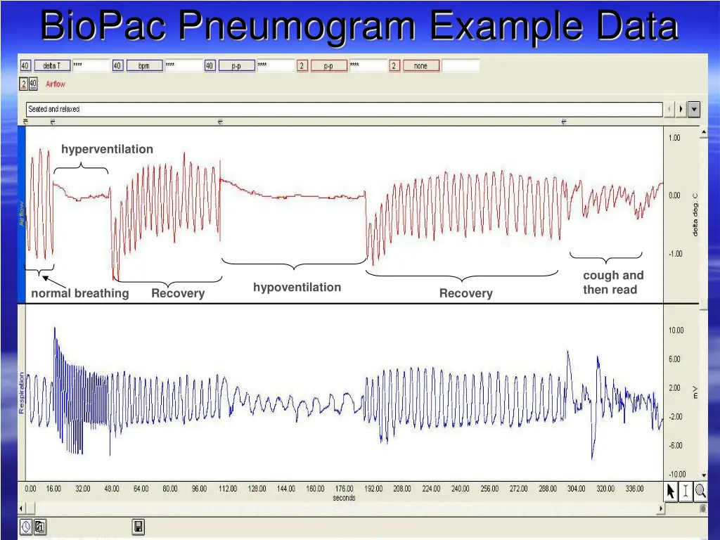 biopac pneumogram example data