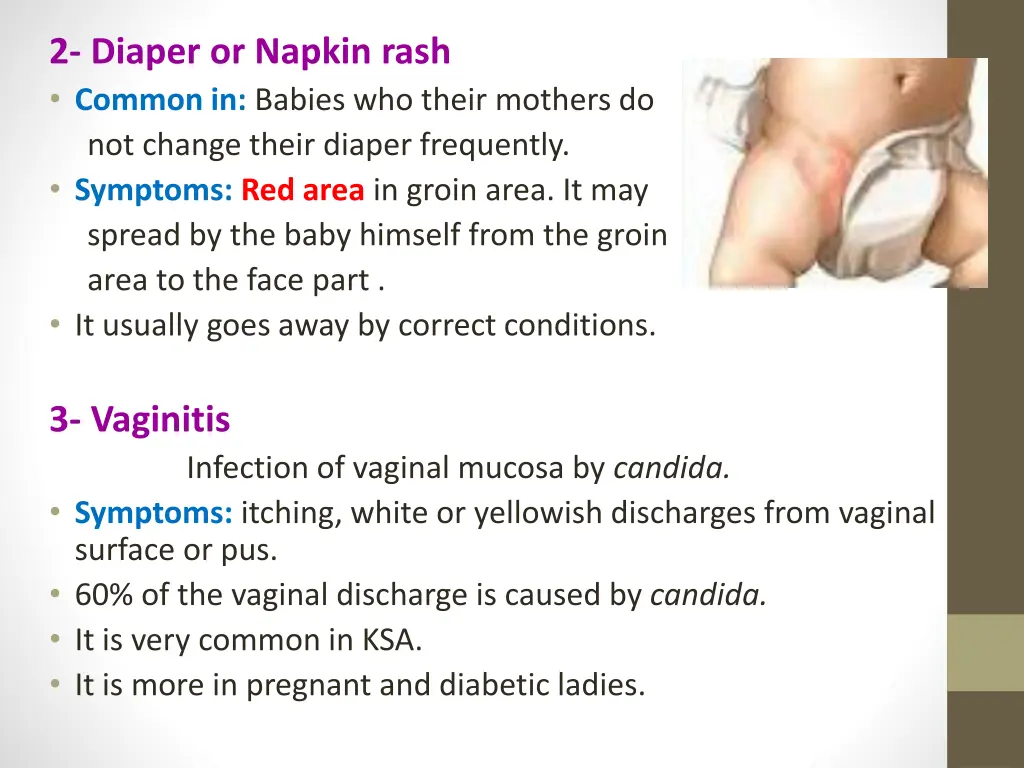 2 diaper or napkin rash common in babies