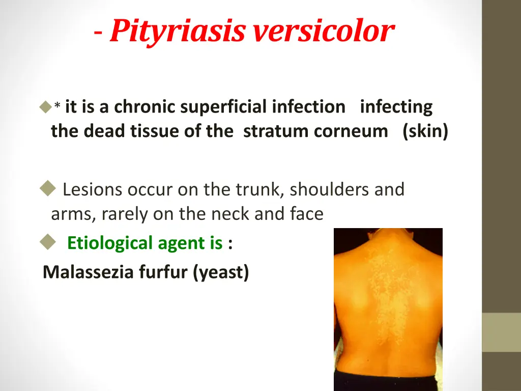 pityriasis versicolor