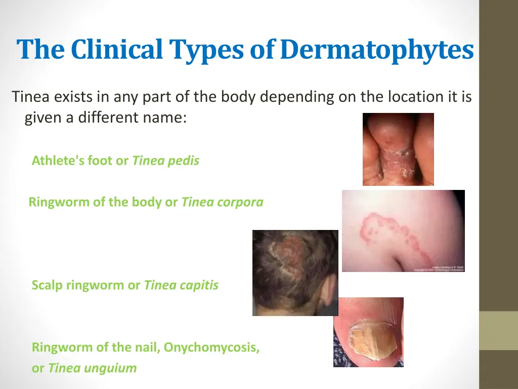 the clinical types of dermatophytes