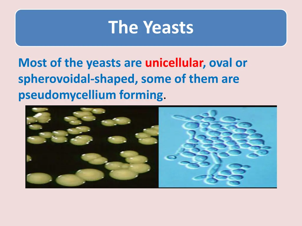 the yeasts