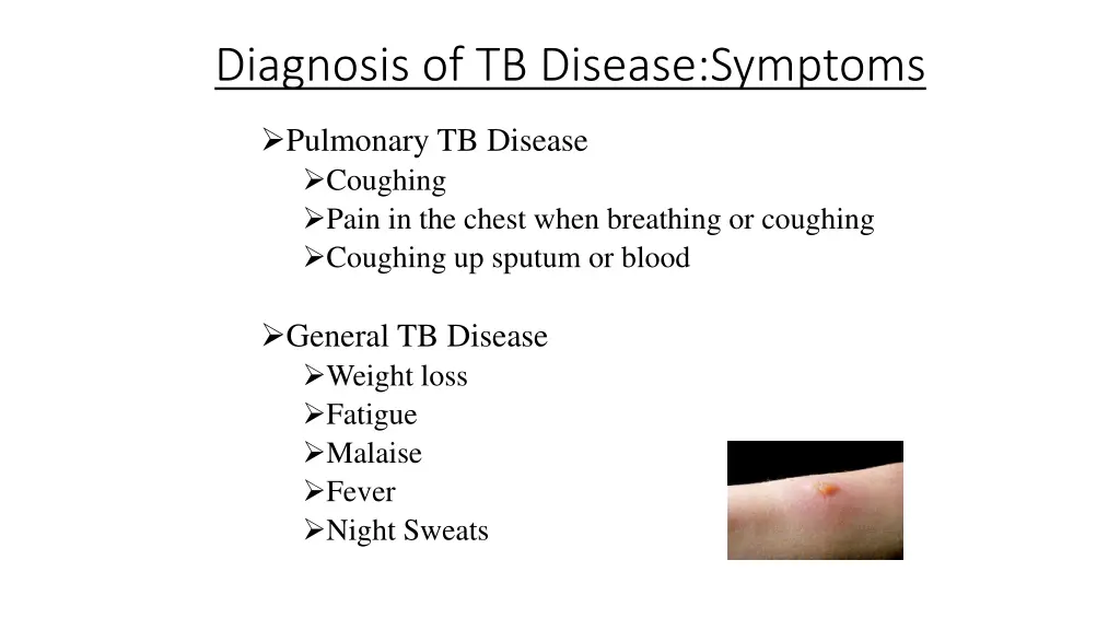 diagnosis of tb disease symptoms