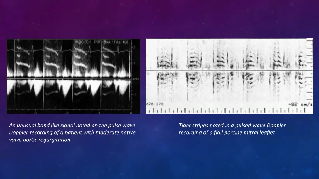 an unusual band like signal noted on the pulse