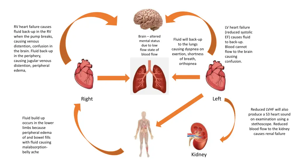 rv heart failure causes fluid back