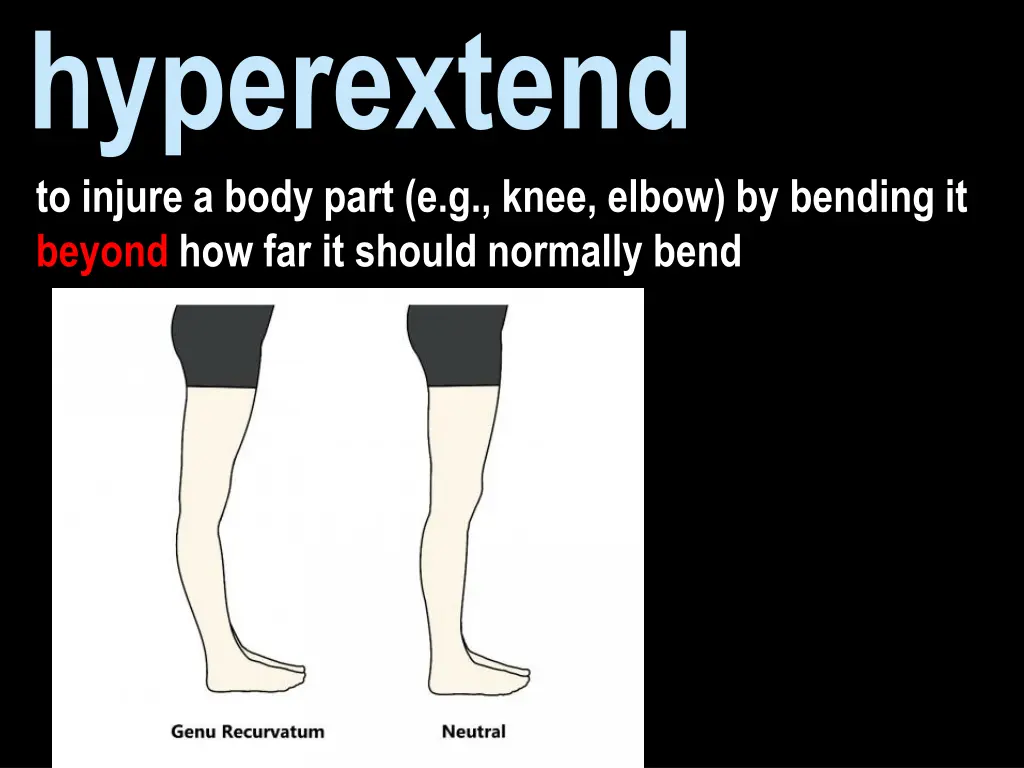 hyperextend to injure a body part e g knee elbow